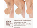 Depiladora IPL - Philips Lumea S9900 BRI951/01, Luz Pulsada en Casa, Con SkinIA y app, Uso Con y Sin Cable, 4 cabezales, Sensor de Piel Inteligente